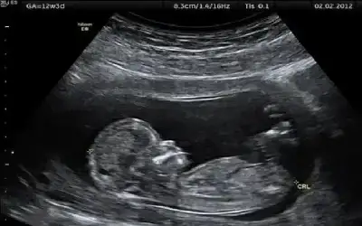 امرأة نيسان ـ 4 خرافات شائعة حول فحوصات ما